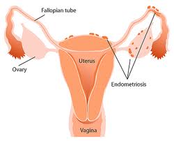 menstruacio-3